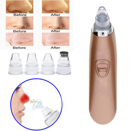Electric Face Pore Cleaner